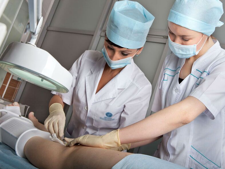 Ablation au laser pour les varices