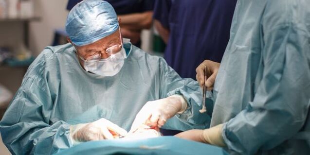 Chirurgie pour enlever les varices